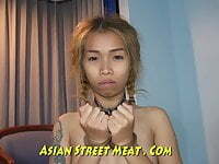 Wire Up Teeth And Gaiping Asian Ass Hole